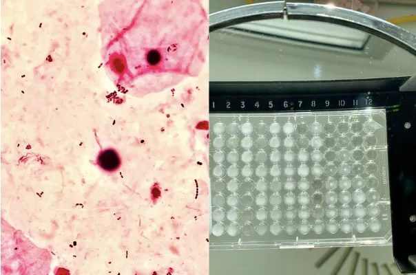 analyse bactérienne