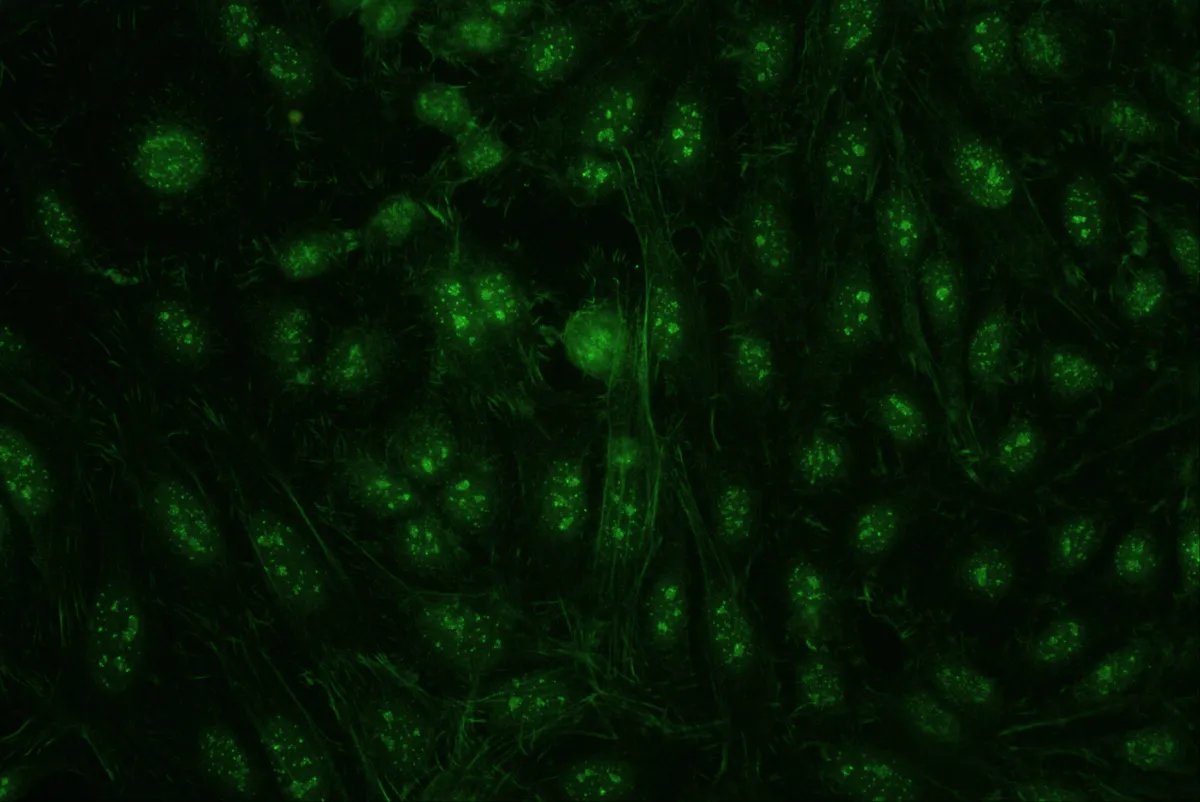 Photo de fluorescence - immunologie