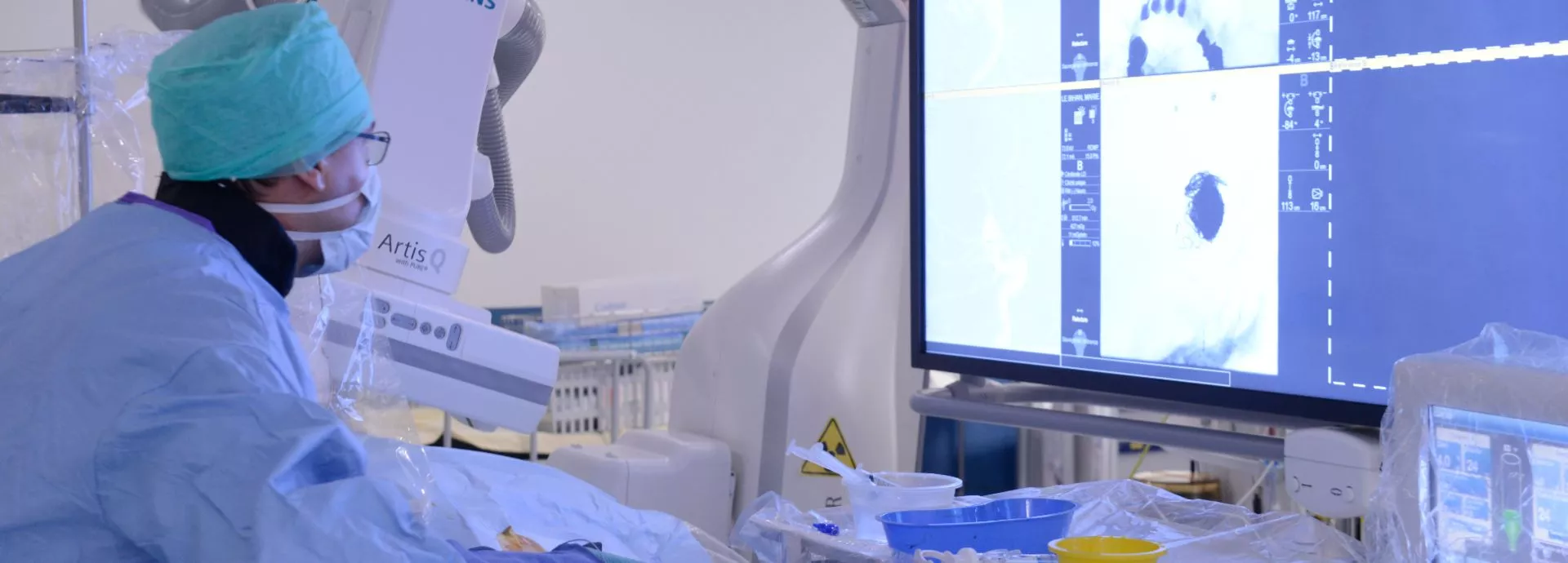 Opération de neuro radiologie interventionnelle en cours