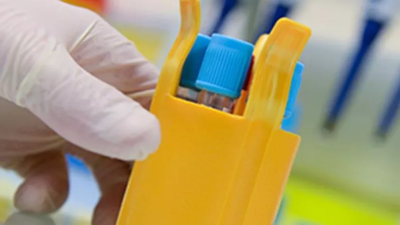 Cette étude PREOB-ON3 est une étude pivotale sur l’efficacité et la sécurité de l’implantation de cellules ostéoblastiques autologues (PREOB®) d'origine médullaire dans les lésions d’ostéonécrose non-traumatique de la tête fémorale.