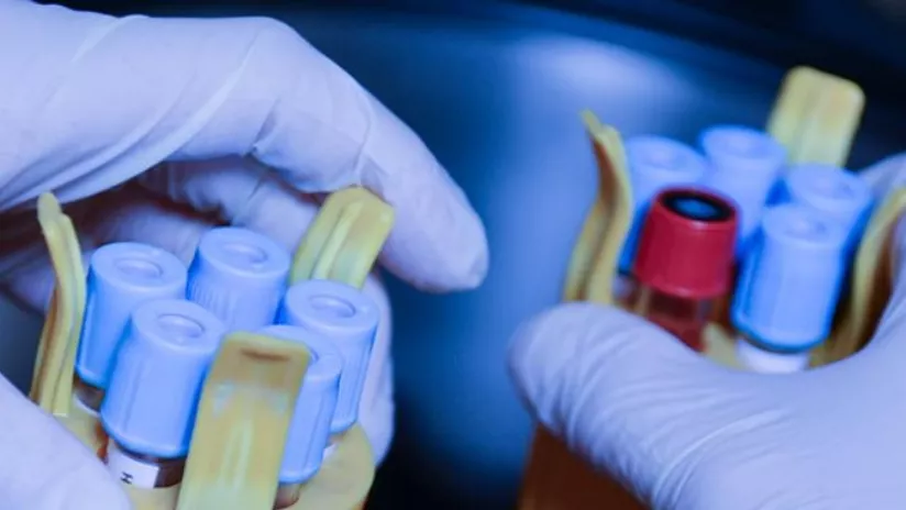 Mains qui manipulent des tubes de prélèvement