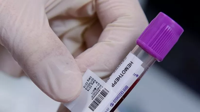Une scientifique pose une étiquette sur un tube de prélèvement
