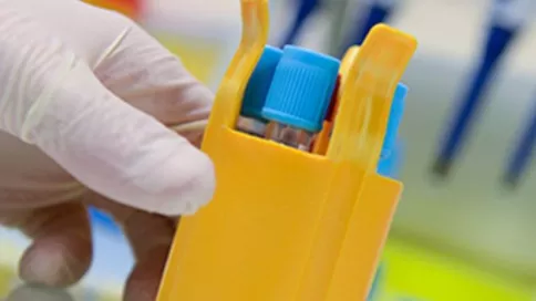Cette étude PREOB-ON3 est une étude pivotale sur l’efficacité et la sécurité de l’implantation de cellules ostéoblastiques autologues (PREOB®) d'origine médullaire dans les lésions d’ostéonécrose non-traumatique de la tête fémorale.