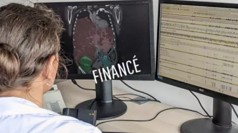 Étude financée - Décrire l’épidémiologie et analyser les variabilités cliniques et génétiques de la polykystose hépatique (maladie génétique rare du foie) dans l’Ouest de la France pour favoriser le développement de nouveaux traitements.