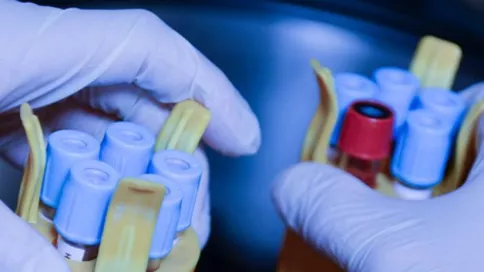 Mains qui manipulent des tubes de prélèvement