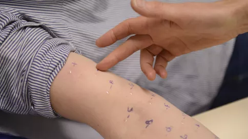 focus sur un bras avec des points pour tester les allergies